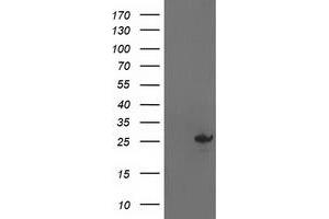 HEK293T cells were transfected with the pCMV6-ENTRY control (Left lane) or pCMV6-ENTRY AK4 (Right lane) cDNA for 48 hrs and lysed. (AK4 antibody)