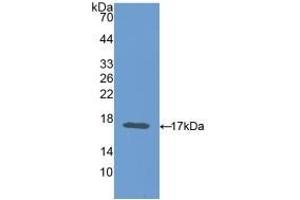 Detection of Recombinant CEA, Mouse using Polyclonal Antibody to Carcinoembryonic Antigen (CEA) (CEA antibody  (AA 85-222))