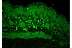 Immunohistochemistry analysis using Rabbit Anti-HSP110 Polyclonal Antibody . (HSPA4 antibody  (Atto 390))