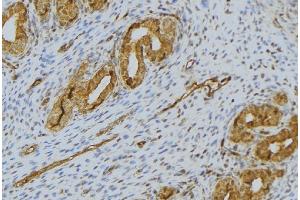 ABIN6276508 at 1/100 staining Human uterus tissue by IHC-P. (SPINK1 antibody  (Internal Region))