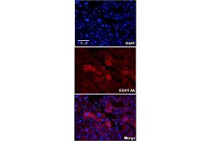 Immunofluorescent staining of human adult liver with EEA1 polyclonal antibody  at 1:100 dilution. (EEA1 antibody  (N-Term))
