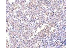 Immunohistochemistry (IHC) image for anti-Lymphocyte Antigen 96 (LY96) antibody (ABIN1031731) (LY96 antibody)