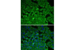 Immunofluorescence analysis of A-549 cells using EEF2K antibody (ABIN6130354, ABIN6139955, ABIN6139956 and ABIN7101771). (EEF2K antibody  (AA 406-725))