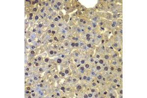 Immunohistochemistry of paraffin-embedded mouse liver using SORT1 antibody. (Sortilin 1 antibody  (AA 520-760))