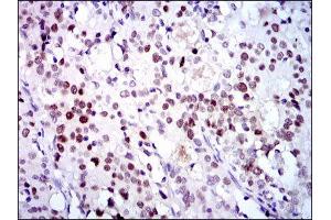 Immunohistochemistry (IHC) image for anti-Cyclin-Dependent Kinase 2 (CDK2) antibody (ABIN1845617) (CDK2 antibody)