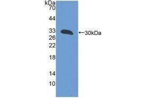 Detection of Recombinant GFM1, Mouse using Polyclonal Antibody to G-Elongation Factor, Mitochondrial 1 (GFM1) (GFM1 antibody  (AA 511-751))
