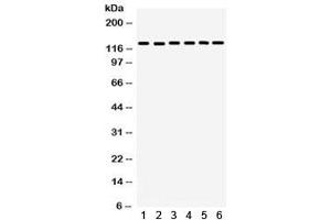 Western blot testing of 1) rat lung, 2) mouse lung, 3) rat brain, 4) human U20S, 5) human HeLa, 6) mouse NIH3T3 lysate with FAK antibody. (FAK antibody)
