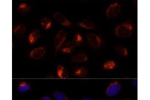 Immunofluorescence analysis of U-2 OS cells using TXNDC12 Polyclonal Antibody at dilution of 1:100 (40x lens).