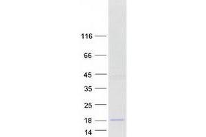 SPAG11B Protein (Transcript Variant D) (Myc-DYKDDDDK Tag)
