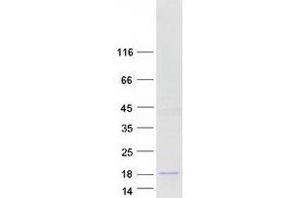 SPAG11B Protein (Transcript Variant D) (Myc-DYKDDDDK Tag)