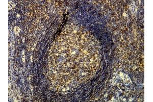 Immunohistochemistry (IHC) image for anti-Listeria Monocytogenes, P60 (AA 527-542), (C-Term) antibody (ABIN7598862) (Listeria Monocytogenes, P60 (AA 527-542), (C-Term) antibody)