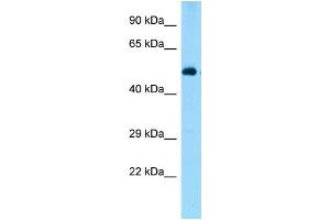 WB Suggested Anti-Zbtb44 Antibody Titration: 1. (ZBTB44 antibody  (N-Term))