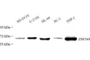 Western blot analysis of ZNF549 (ABIN7076267) at dilution of 1: 1000 (ZNF549 antibody)