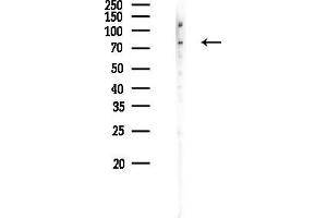 Western blot analysis of lysates from Hela cells(UV 30 min treatment), using GARS Antibody at 1/1000 dilution.