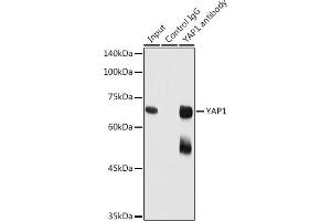 Immunoprecipitation analysis of 300 μg extracts of HeLa cells using 3 μg Y antibody (ABIN6132788, ABIN6150316, ABIN6150321 and ABIN6215135). (YAP1 antibody  (AA 155-504))