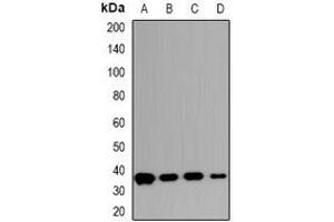Western blot analysis of Carbonic Anhydrase 13 expression in HepG2 (A), HCT116 (B), mouse intestines (C), rat intestines (D) whole cell lysates.