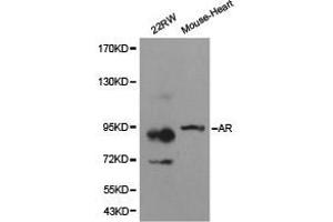 Western Blotting (WB) image for anti-Androgen Receptor (AR) antibody (ABIN1871059) (Androgen Receptor antibody)