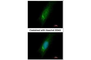 ICC/IF Image Immunofluorescence analysis of methanol-fixed HeLa, using Homer3, antibody at 1:500 dilution. (HOMER3 antibody  (Center))
