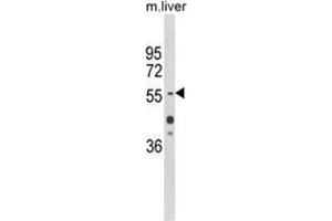 Western blot analysis of HNF1A Antibody (Center) in mouse liver tissue lysates (35ug/lane). (HNF1A antibody  (Middle Region))