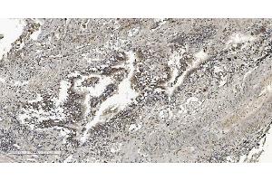 IHC analysis of HP1 alpha/CBX5 using anti-HP1 alpha/CBX5 antibody (ABIN7599057). (CBX5 antibody  (AA 1-191))