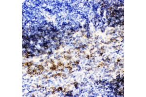 Anti- CD79B picoband antibody,IHC(P) IHC(P): Mouse Spleen Tissue (CD79b antibody  (AA 29-229))