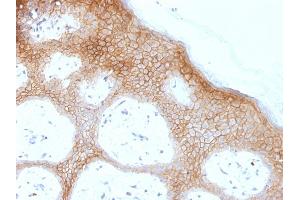 Formalin-fixed, paraffin-embedded human skin stained with Desmoglein-1 Monoclonal Antibody (DSG1/1733). (Desmoglein 1 antibody)