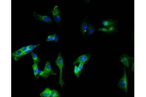 Immunofluorescence (IF) image for anti-Melanoma Cell Adhesion Molecule (MCAM) (AA 50-646) antibody (ABIN7147325)