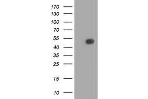 HEK293T cells were transfected with the pCMV6-ENTRY control (Left lane) or pCMV6-ENTRY BECN1 (Right lane) cDNA for 48 hrs and lysed. (Beclin 1 antibody)