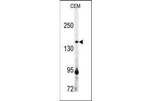 Western blot analysis: ADAMTS13 antibody staining of CEM cell line lysates (35 µg/lane). (ADAMTS13 antibody  (AA 836-866))