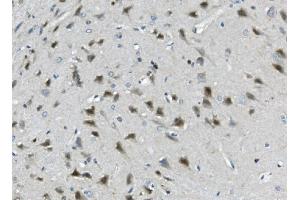 IHC analysis of Calretinin/CALB2 using anti-Calretinin/CALB2 antibody (ABIN7602106). (Calretinin antibody  (AA 59-90))