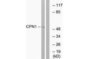 Western blot analysis of extracts from RAW264. (CPN1 antibody  (AA 409-458))