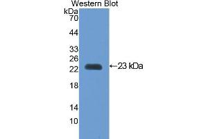 Western Blotting (WB) image for anti-Vascular Cell Adhesion Molecule 1 (VCAM1) (AA 116-309) antibody (ABIN1078645)
