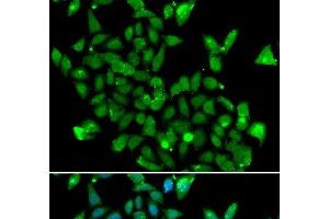 Immunofluorescence analysis of MCF-7 cells using ASPA Polyclonal Antibody (ASPA antibody)
