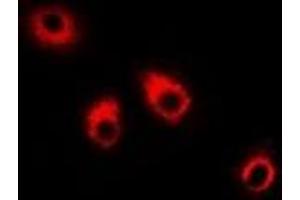 Immunofluorescent analysis of Eppin staining in HepG2 cells. (Eppin antibody)