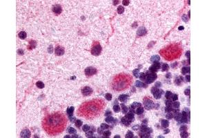 Anti-Kappa Opioid Receptor antibody IHC of rat brain, Purkinje neurons. (OPRK1 antibody  (Extracellular Domain))