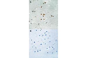 Immunohistochemical staining (Formalin-fixed paraffin-embedded sections) of human brain tissue with FER (phospho Y402) polyclonal antibody  without blocking peptide (A) or preincubated with blocking peptide (B) under 1:50-1:100 dilution.