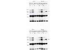 Image no. 1 for anti-Vav 2 Guanine Nucleotide Exchange Factor (VAV2) antibody (ABIN291773) (VAV2 antibody)