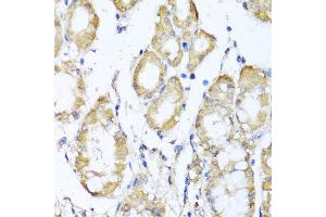 Immunohistochemistry of paraffin-embedded human stomach using KCND2 antibody at dilution of 1:100 (x40 lens). (KCND2 antibody)