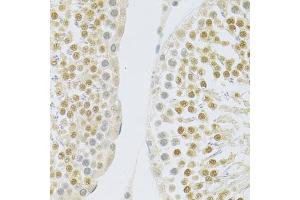 Immunohistochemistry of paraffin-embedded rat testis using SLC39A7 antibody (ABIN1874835) at dilution of 1:100 (40x lens).
