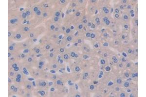 DAB staining on IHC-P; Samples: Mouse Liver Tissue (IL13 Receptor alpha 1 antibody  (AA 201-360))