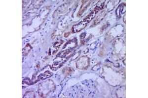 Immunohistochemistry (Paraffin-embedded Sections) (IHC (p)) image for anti-Colony Stimulating Factor 3 (Granulocyte) (CSF3) (AA 155-198) antibody (ABIN736521)