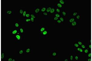 Immunofluorescent analysis of HepG2 cells using ABIN7161805 at dilution of 1:100 and Alexa Fluor 488-congugated AffiniPure Goat Anti-Rabbit IgG(H+L) (PPP1R8 antibody  (AA 1-209))