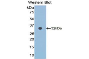 Western Blotting (WB) image for anti-Collagen, Type III, alpha 1 (COL3A1) (AA 1171-1435) antibody (ABIN1077676)