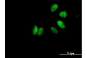 Immunofluorescence of purified MaxPab antibody to CHEK2 on HeLa cell. (CHEK2 antibody  (AA 1-543))