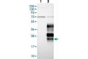 Western blot analysis of Lane 1: Negative control (vector only transfected HEK293T lysate), Lane 2: Over-expression Lysate (Co-expressed with a C-terminal myc-DDK tag (~3. (OPALIN antibody)