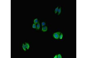 Immunofluorescent analysis of HepG2 cells using ABIN7161789 at dilution of 1: 100 and Alexa Fluor 488-congugated AffiniPure Goat Anti-Rabbit IgG(H+L) (NFATC1 antibody  (AA 48-406))