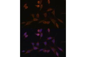 Immunofluorescence analysis of NIH-3T3 cells using NDUF Polyclonal Antibody (ABIN7268804) at dilution of 1:100 (40x lens). (NDUFA5 antibody  (AA 1-116))