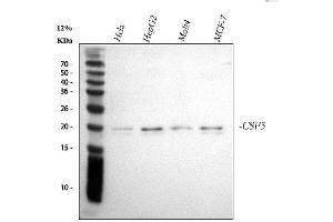 Western blot analysis of G-CSF/CSF3 using anti-G-CSF/CSF3 antibody (ABIN3042762).