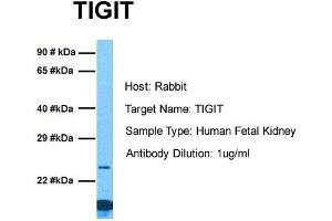 Host: Rabbit Target Name: TIGIT Sample Tissue: Human Fetal Kidney Antibody Dilution: 1. (TIGIT antibody  (C-Term))