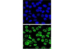 Confocal immunofluorescent analysis of MDM2 Antibody  (ABIN388067 and ABIN2845752) with Hela cell followed by Alexa Fluor® 488-conjugated goat anti-rabbit lgG (green). (MDM2 antibody  (AA 141-176))
